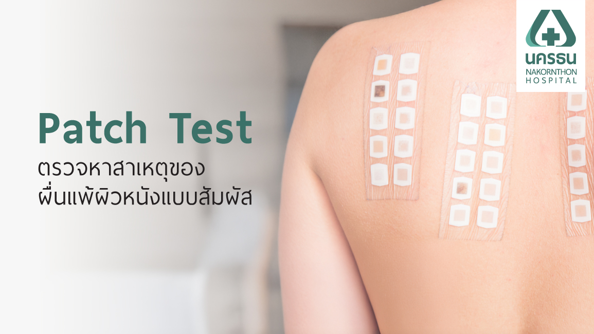 Patch Test